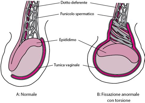 dolore testicolo sinistro|disturbo testicolare.